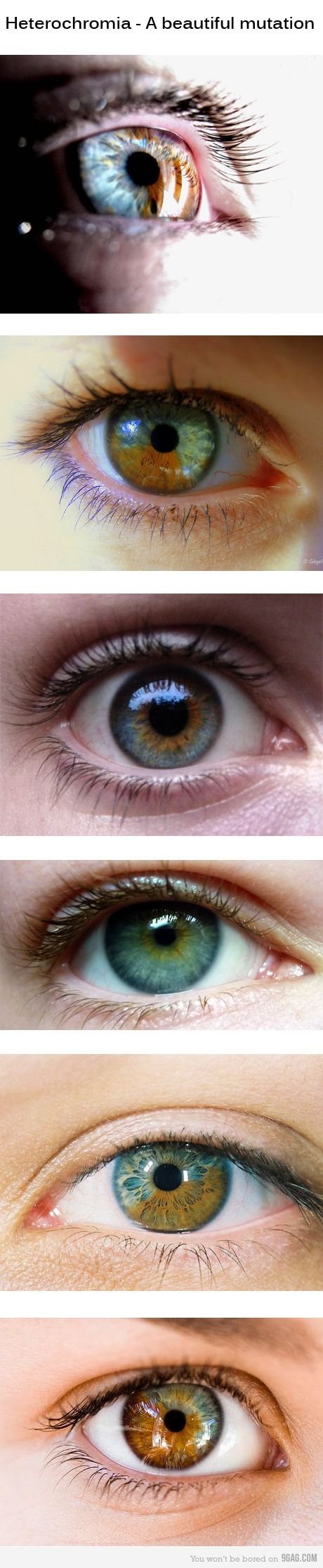 eyes heterochromia